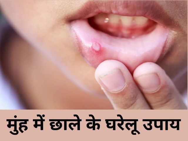 Mouth Blisters muh me chhale
